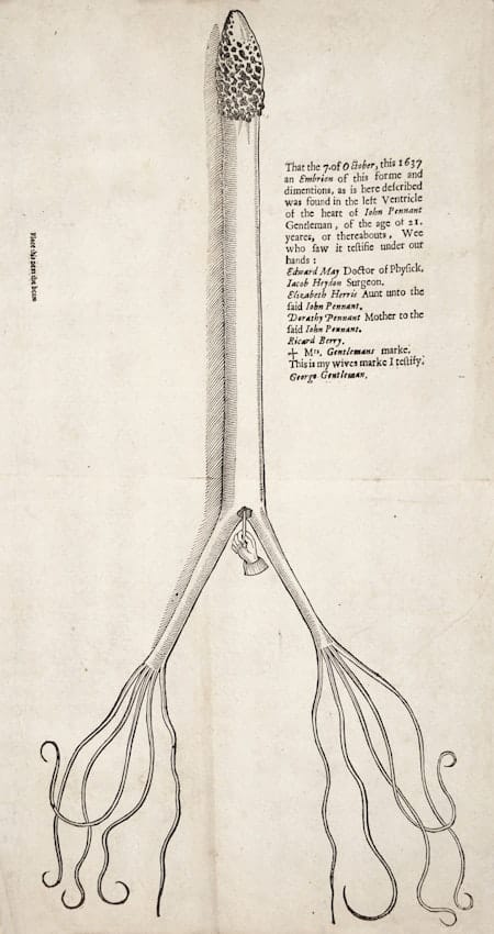 a woodblock of the serpent removed from the heart and laid flat